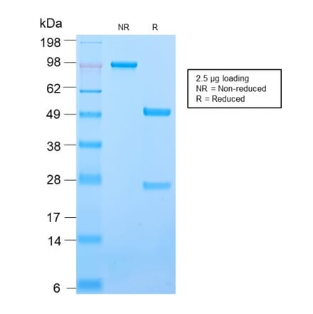 SDS-PAGE - Anti-ICAM3 Antibody [ICAM3/2873R] - BSA and Azide free (A252093) - Antibodies.com