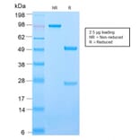 SDS-PAGE - Anti-ICAM3 Antibody [ICAM3/2873R] - BSA and Azide free (A252093) - Antibodies.com