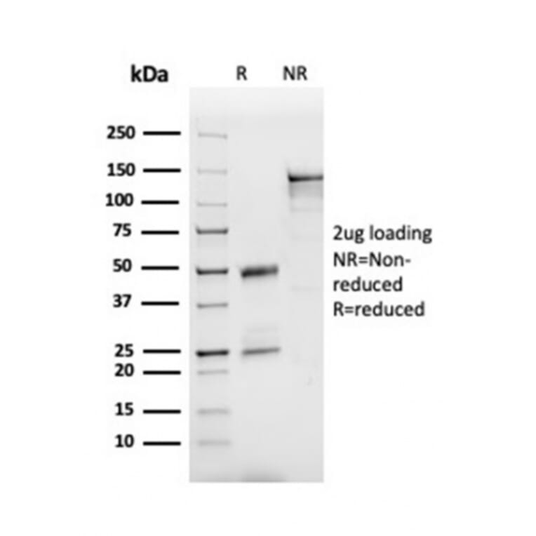 SDS-PAGE - Anti-Apolipoprotein B Antibody [APOB/3300] - BSA and Azide free (A252094) - Antibodies.com