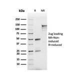 SDS-PAGE - Anti-Apolipoprotein B Antibody [APOB/3300] - BSA and Azide free (A252094) - Antibodies.com