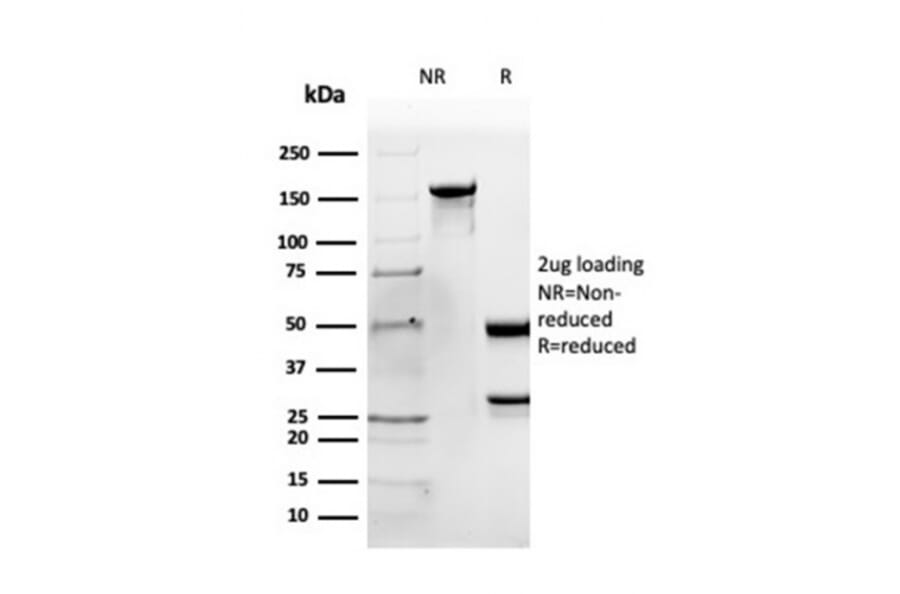SDS-PAGE - Anti-Apolipoprotein B Antibody [APOB/4333] - BSA and Azide free (A252095) - Antibodies.com