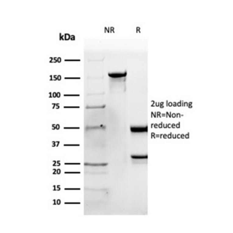 SDS-PAGE - Anti-Apolipoprotein B Antibody [APOB/4333] - BSA and Azide free (A252095) - Antibodies.com