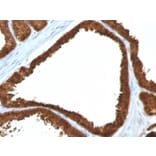 Immunohistochemistry - Anti-IDH1 Antibody [IDH1/1152] - BSA and Azide free (A252095) - Antibodies.com