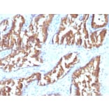 Immunohistochemistry - Anti-IDH1 Antibody [IDH1/1152] - BSA and Azide free (A252096) - Antibodies.com