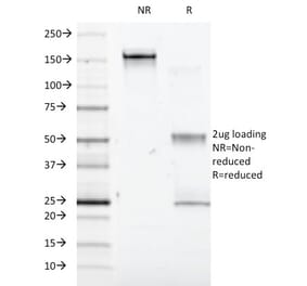 SDS-PAGE - Anti-Interferon alpha 1 Antibody [2-48] - BSA and Azide free (A252096) - Antibodies.com