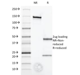 SDS-PAGE - Anti-Interferon alpha 1 Antibody [2-52] - BSA and Azide free (A252097) - Antibodies.com