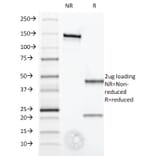 SDS-PAGE - Anti-Interferon alpha 1 Antibody [2-52] - BSA and Azide free (A252097) - Antibodies.com