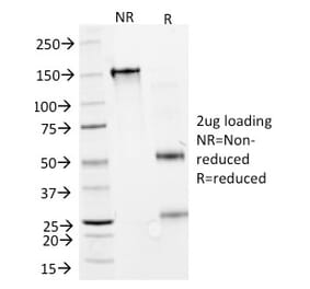 SDS-PAGE - Anti-Interferon alpha 2 Antibody [N27] - BSA and Azide free (A252098) - Antibodies.com