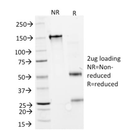 SDS-PAGE - Anti-Interferon alpha 2 Antibody [N27] - BSA and Azide free (A252098) - Antibodies.com