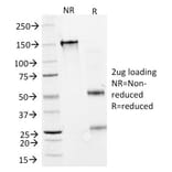 SDS-PAGE - Anti-Interferon alpha 2 Antibody [N27] - BSA and Azide free (A252098) - Antibodies.com