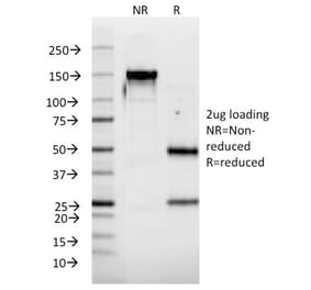 SDS-PAGE - Anti-Interferon alpha 2 Antibody [N39] - BSA and Azide free (A252099) - Antibodies.com