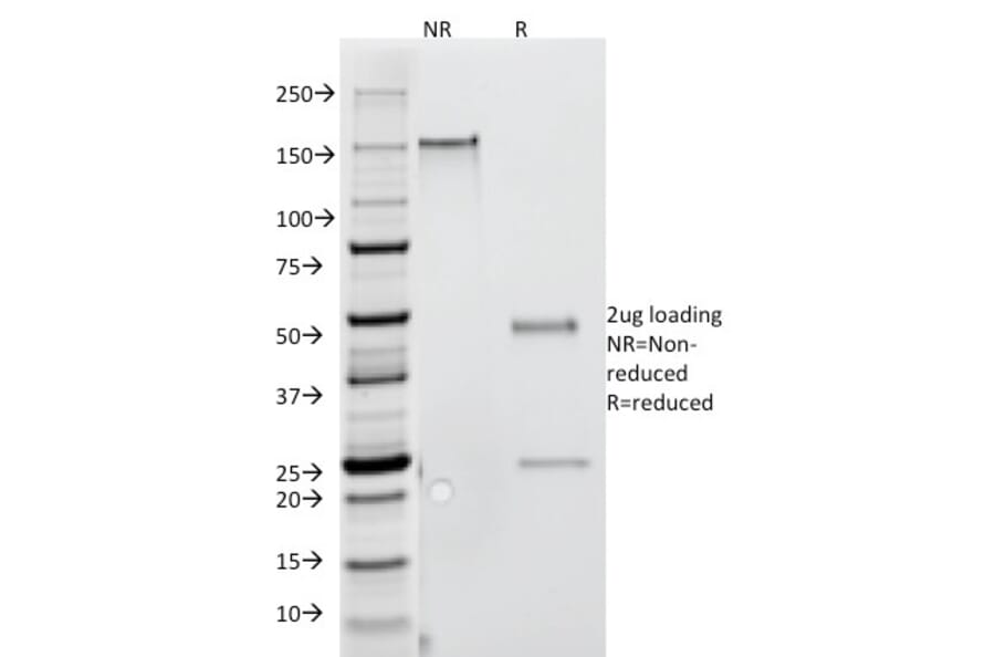 SDS-PAGE - Anti-Interferon gamma Antibody [G-23] - BSA and Azide free (A252100) - Antibodies.com