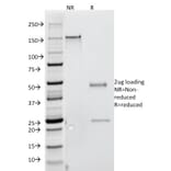 SDS-PAGE - Anti-Interferon gamma Antibody [G-23] - BSA and Azide free (A252100) - Antibodies.com