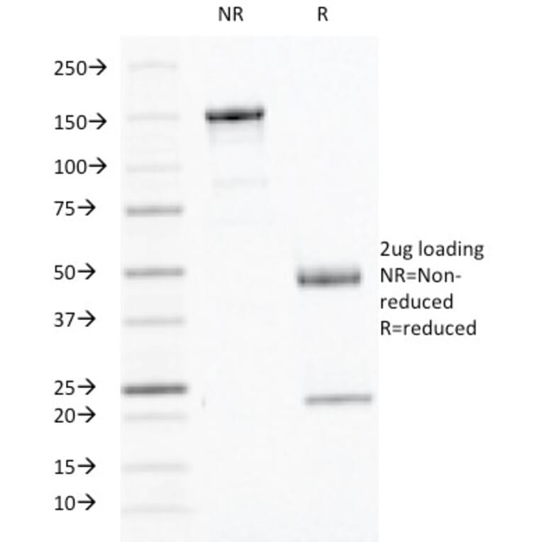 SDS-PAGE - Anti-Interferon gamma Antibody [IFNG/466] - BSA and Azide free (A252105) - Antibodies.com