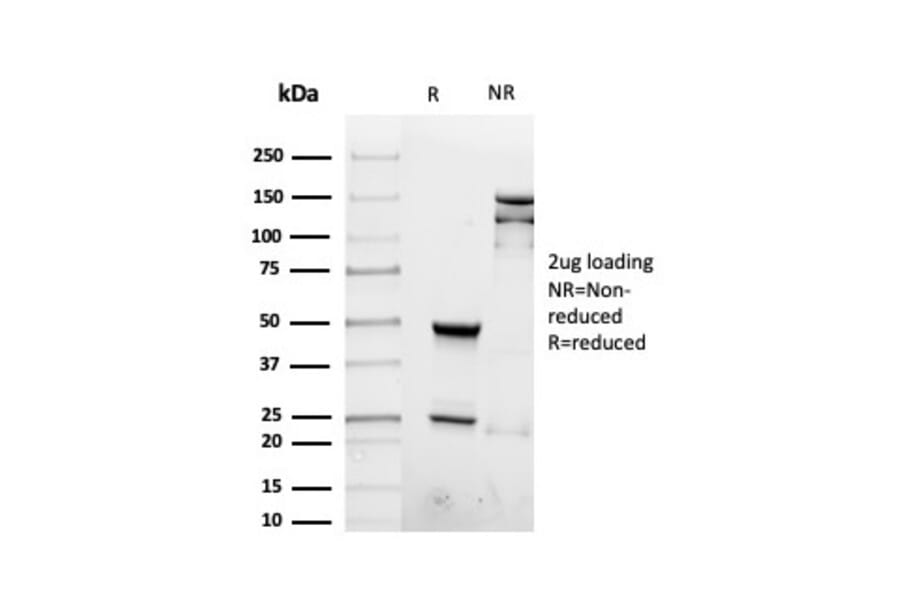 SDS-PAGE - Anti-Interferon gamma Antibody [rIFNG/4467] - BSA and Azide free (A252107) - Antibodies.com