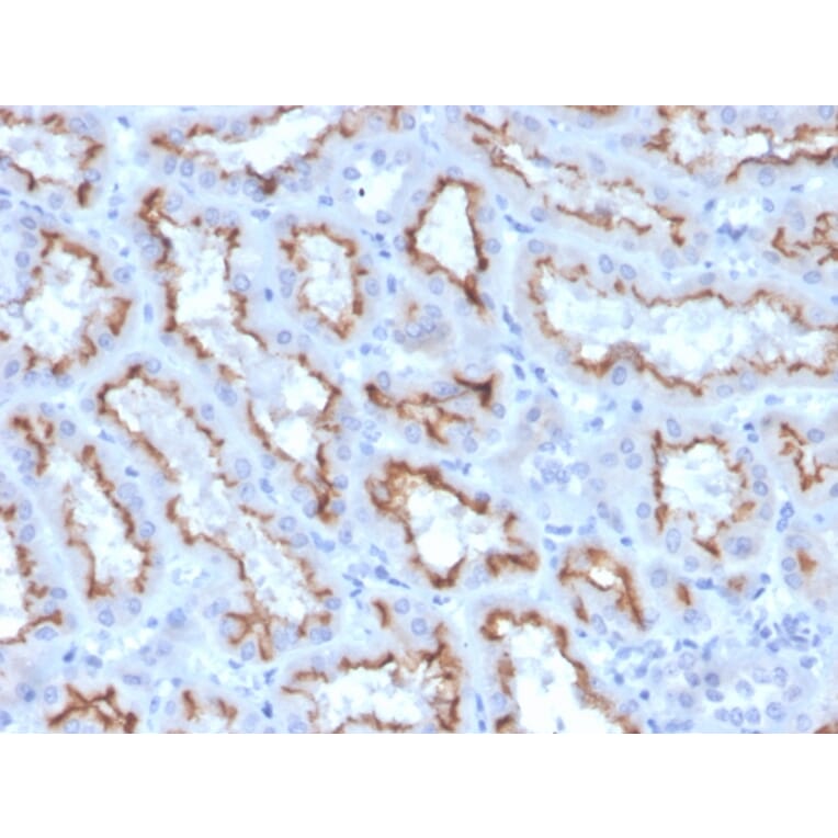 Immunohistochemistry - Anti-Interferon gamma Antibody [IFNG/3996R] - BSA and Azide free (A252108) - Antibodies.com