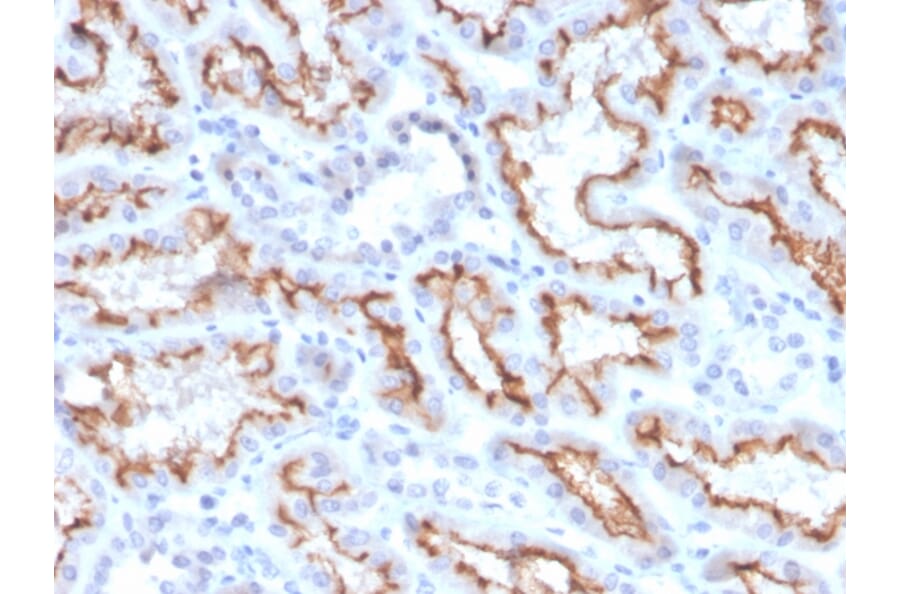 Immunohistochemistry - Anti-Interferon gamma Antibody [IFNG/3996R] - BSA and Azide free (A252107) - Antibodies.com