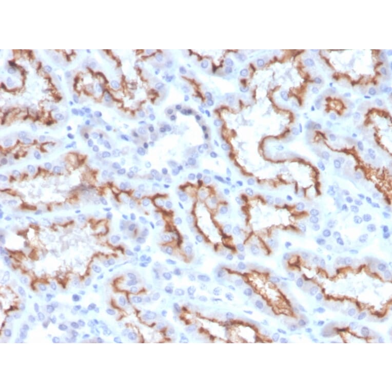 Immunohistochemistry - Anti-Interferon gamma Antibody [IFNG/3996R] - BSA and Azide free (A252107) - Antibodies.com