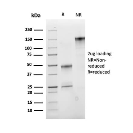 SDS-PAGE - Anti-IGF1 Antibody [M23] - BSA and Azide free (A252108) - Antibodies.com