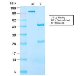 SDS-PAGE - Anti-IGF1 Antibody [IGF1/2872R] - BSA and Azide free (A252112) - Antibodies.com