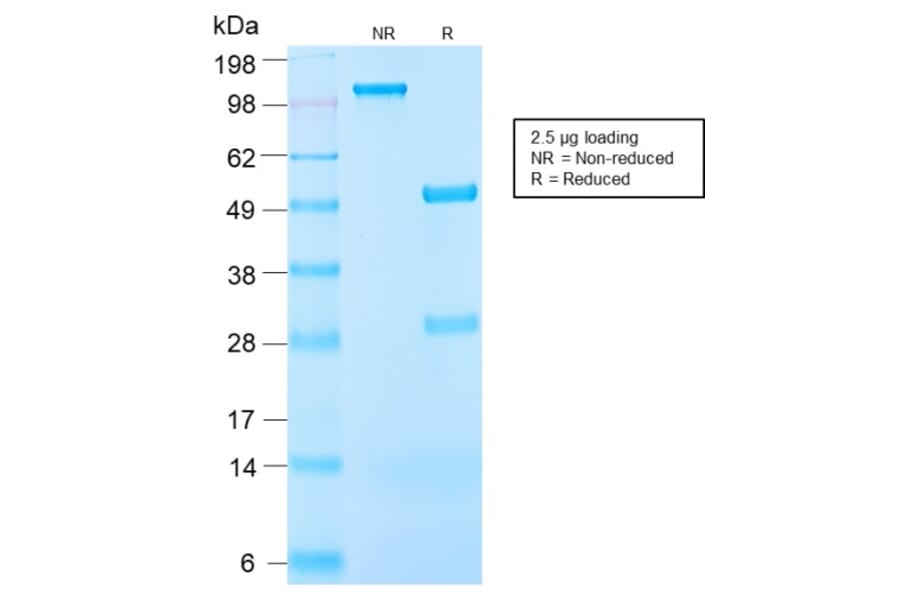 SDS-PAGE - Anti-IGF1 Antibody [IGF1/2872R] - BSA and Azide free (A252112) - Antibodies.com