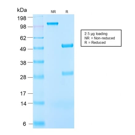 SDS-PAGE - Anti-IGF1 Antibody [IGF1/2872R] - BSA and Azide free (A252112) - Antibodies.com