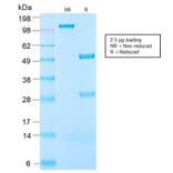 SDS-PAGE - Anti-IGF1 Antibody [IGF1/2872R] - BSA and Azide free (A252112) - Antibodies.com