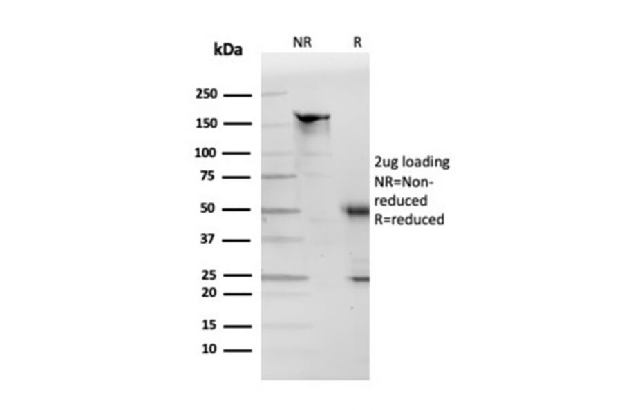 SDS-PAGE - Anti-Apolipoprotein D Antibody [APOD/3412] - BSA and Azide free (A252113) - Antibodies.com