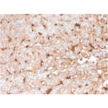 Immunohistochemistry - Anti-Apolipoprotein D Antibody [APOD/3414] - BSA and Azide free (A252114) - Antibodies.com