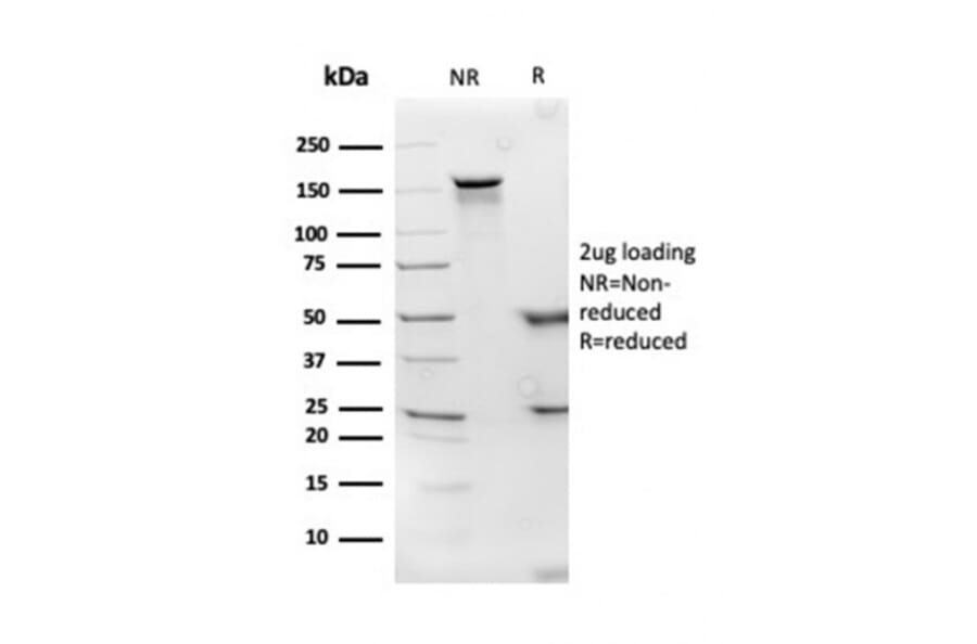 SDS-PAGE - Anti-Apolipoprotein D Antibody [APOD/3414] - BSA and Azide free (A252114) - Antibodies.com