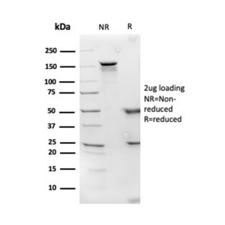 SDS-PAGE - Anti-Apolipoprotein D Antibody [APOD/3414] - BSA and Azide free (A252114) - Antibodies.com