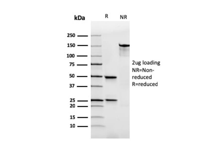 SDS-PAGE - Anti-Human IgA Heavy Chain Antibody [rHISA43] - BSA and Azide free (A252118) - Antibodies.com