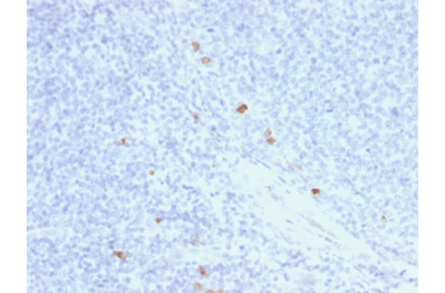 Immunohistochemistry - Anti-Human IgG4 Heavy Chain Antibody [rIGHG4/1345] - BSA and Azide free (A252130) - Antibodies.com