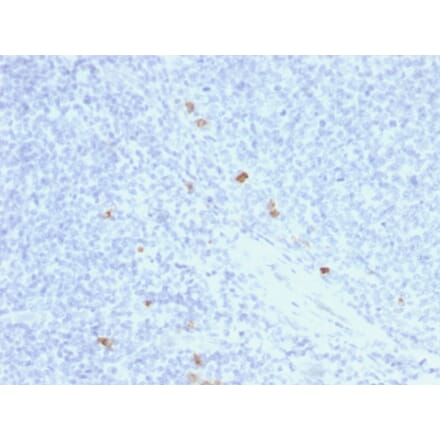 Immunohistochemistry - Anti-Human IgG4 Heavy Chain Antibody [rIGHG4/1345] - BSA and Azide free (A252130) - Antibodies.com
