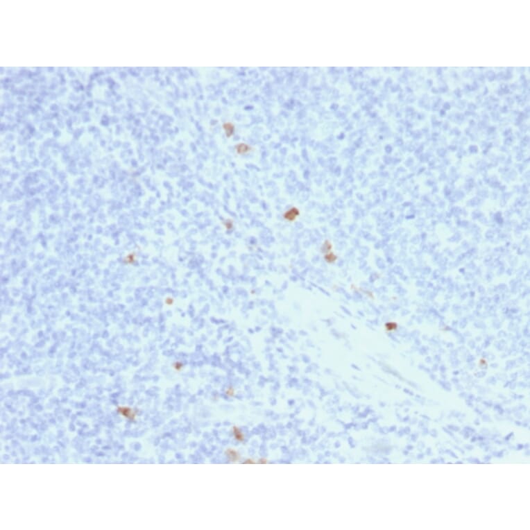 Immunohistochemistry - Anti-Human IgG4 Heavy Chain Antibody [rIGHG4/1345] - BSA and Azide free (A252130) - Antibodies.com