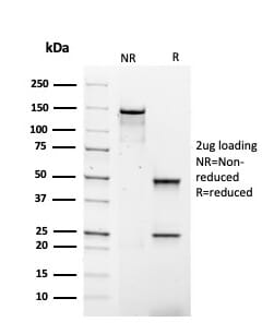 SDS-PAGE analysis of Anti-Human IgG4 Heavy Chain Antibody [rIGHG4/1345] under non-reduced and reduced conditions; showing intact IgG and intact heavy and light chains, respectively. SDS-PAGE analysis confirms the integrity and purity of the antibody.