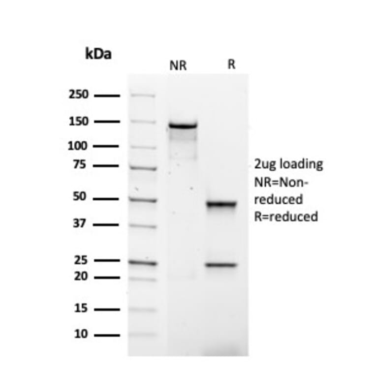 SDS-PAGE - Anti-Human IgG4 Heavy Chain Antibody [rIGHG4/1345] - BSA and Azide free (A252131) - Antibodies.com