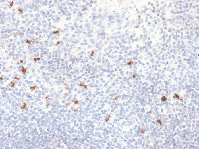 Immunohistochemical analysis of formalin-fixed, paraffin-embedded human tonsil using Anti-Human IgG4 Heavy Chain Antibody [IGHG4/2042R].