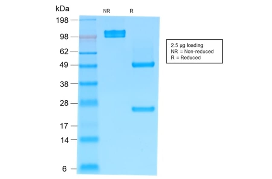 SDS-PAGE - Anti-Human IgM Heavy Chain Antibody [rIM373] - BSA and Azide free (A248953) - Antibodies.com