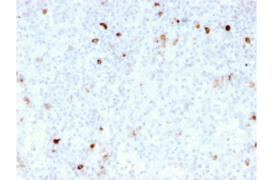 Immunohistochemistry - Anti-Human IgM Heavy Chain Antibody [rIM260] - BSA and Azide free (A248954) - Antibodies.com