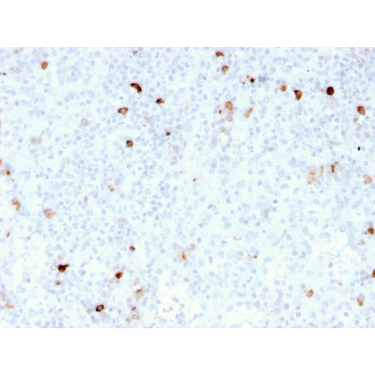 Immunohistochemistry - Anti-Human IgM Heavy Chain Antibody [rIM260] - BSA and Azide free (A248954) - Antibodies.com