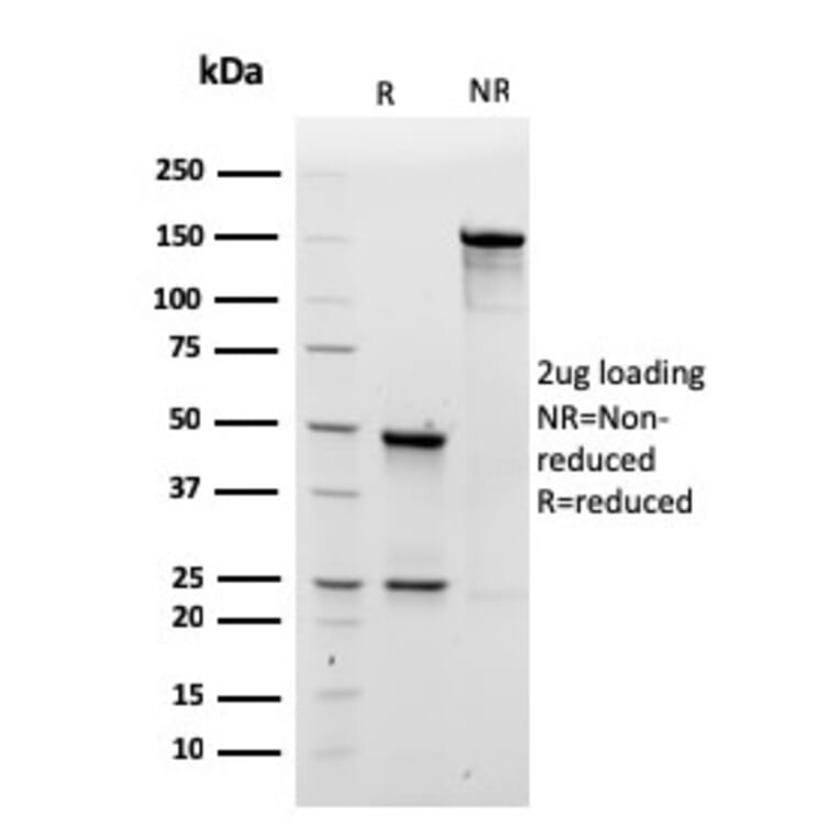 SDS-PAGE - Anti-Human IgM Heavy Chain Antibody [rIM260] - BSA and Azide free (A248954) - Antibodies.com