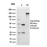 SDS-PAGE - Anti-Human IgM Heavy Chain Antibody [rIM260] - BSA and Azide free (A248954) - Antibodies.com