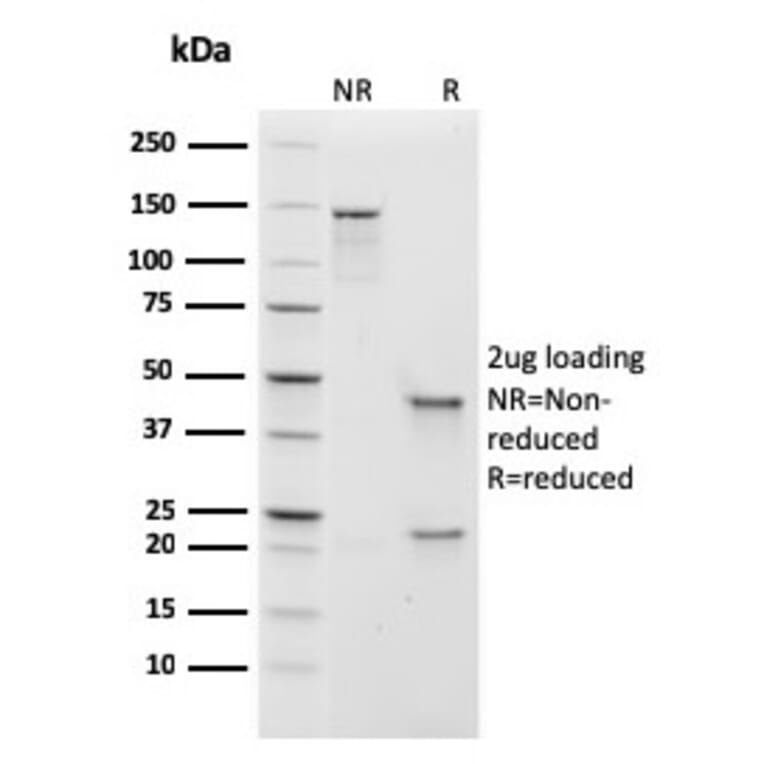 SDS-PAGE - Anti-Human IgM Heavy Chain Antibody [rIGHM/1623] - BSA and Azide free (A252136) - Antibodies.com