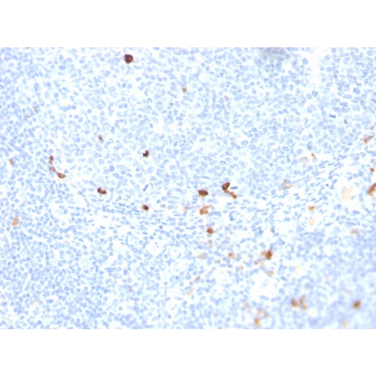 Immunohistochemistry - Anti-Human IgM Heavy Chain Antibody [rIGHM/1623] - BSA and Azide free (A252135) - Antibodies.com