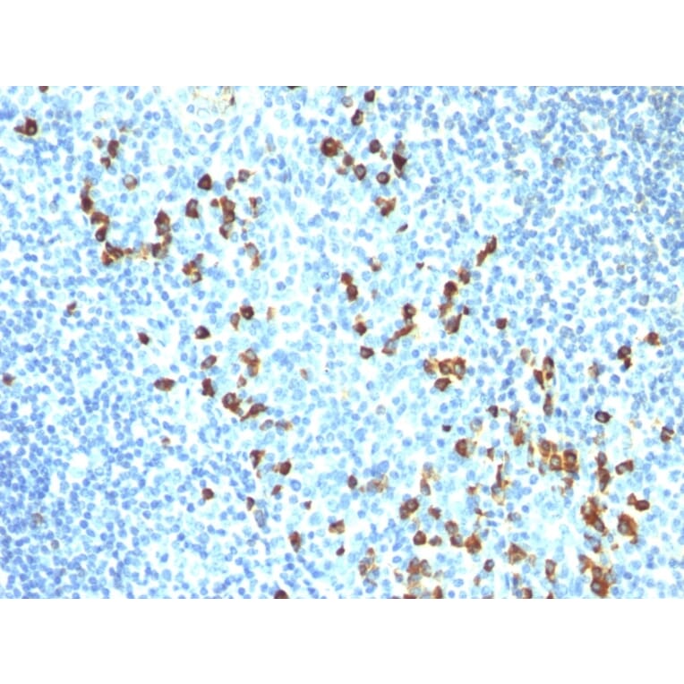 Immunohistochemistry - Anti-Human IgM Heavy Chain Antibody [ICO-30] - BSA and Azide free (A252136) - Antibodies.com