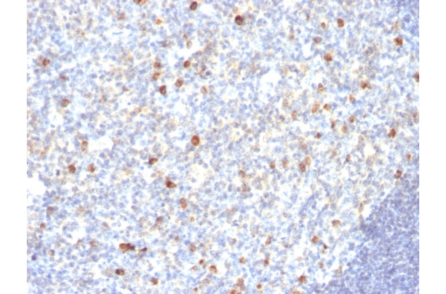 Immunohistochemistry - Anti-Human IgM Heavy Chain Antibody [SPM188] - BSA and Azide free (A252137) - Antibodies.com