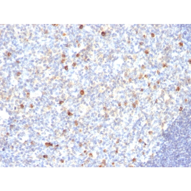 Immunohistochemistry - Anti-Human IgM Heavy Chain Antibody [SPM188] - BSA and Azide free (A252137) - Antibodies.com