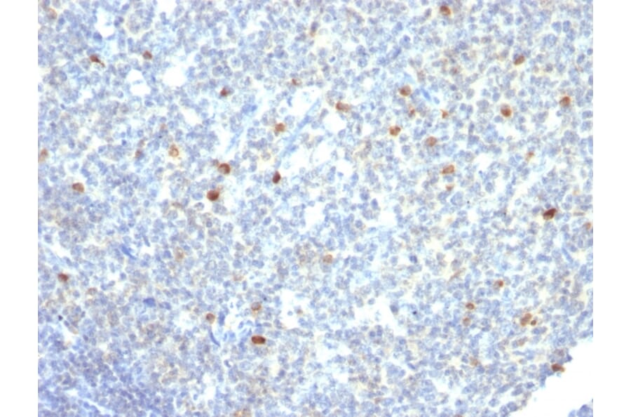 Immunohistochemistry - Anti-Human IgM Heavy Chain Antibody [IM260] - BSA and Azide free (A248960) - Antibodies.com