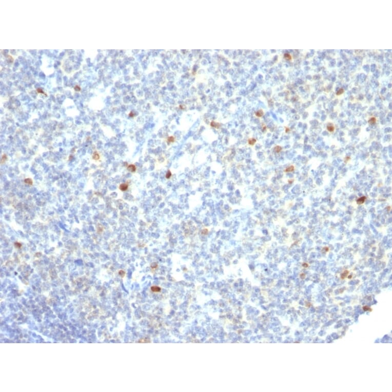 Immunohistochemistry - Anti-Human IgM Heavy Chain Antibody [IM260] - BSA and Azide free (A248960) - Antibodies.com